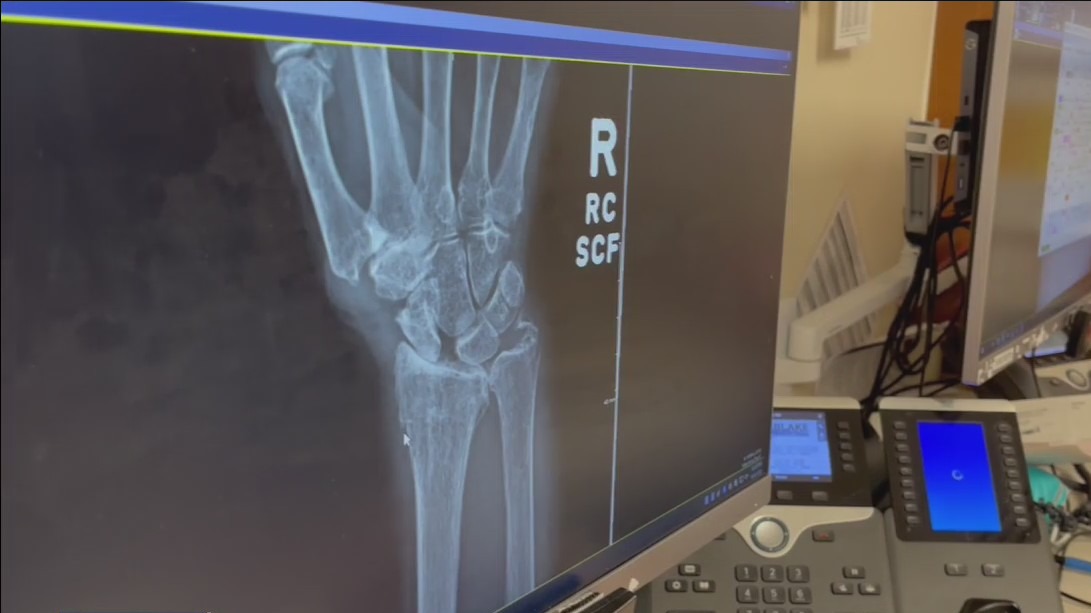 Emergency rooms busy with post-storm injuries
