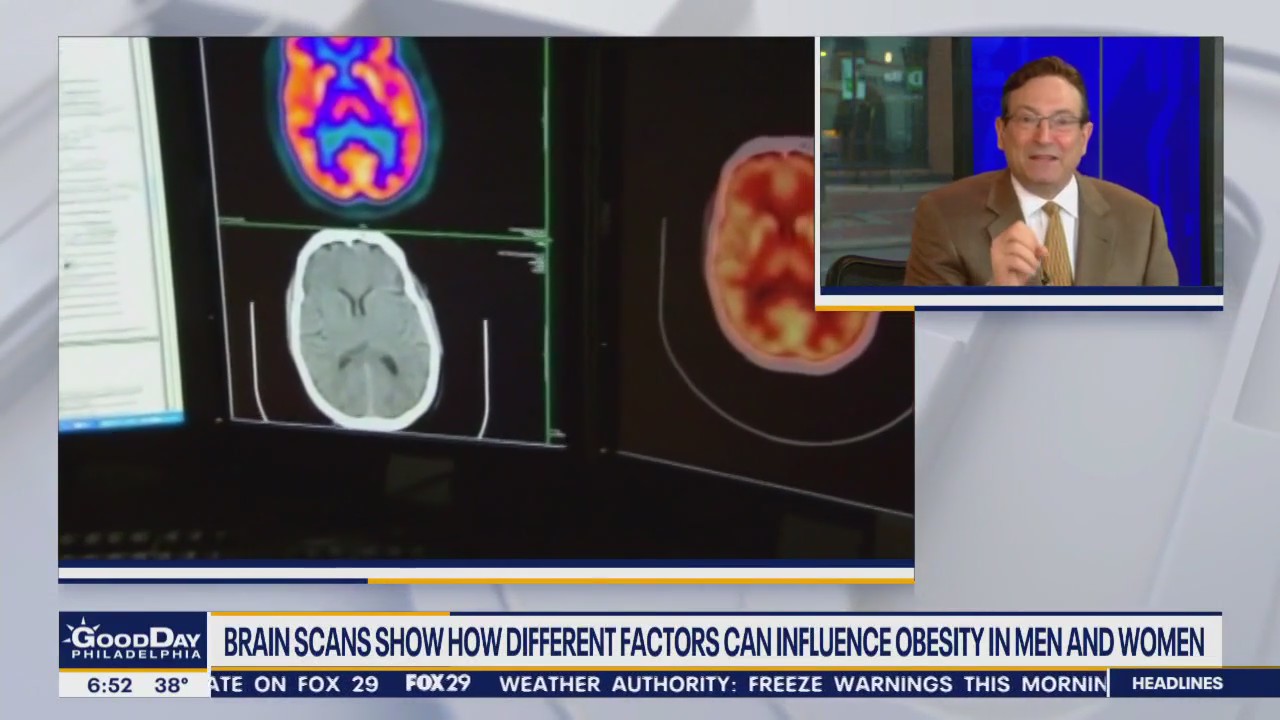 Health Watch: Brain scans reveal obesity factors