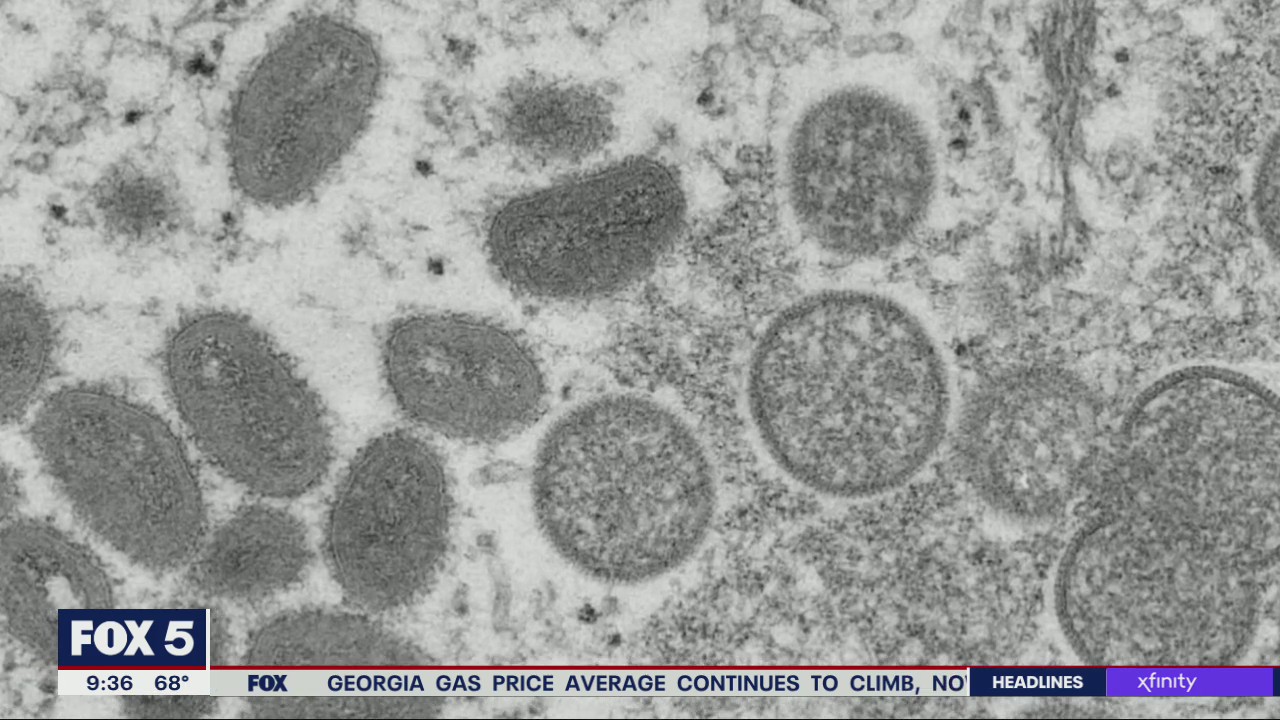 Monkeypox and COVID news update with Dr. Neil Winawer