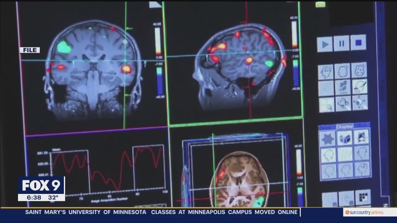 FDA considering accelerated approval of new Alzheimer’s drug