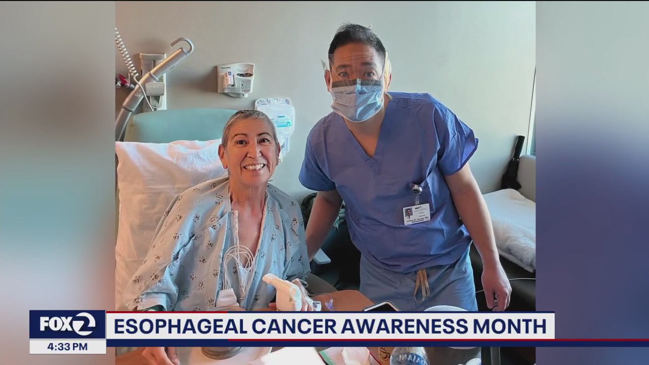 Minimally-invasive surgeries now available to treat esophageal cancer