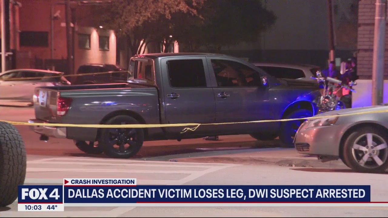Dallas man loses leg after being struck by driver