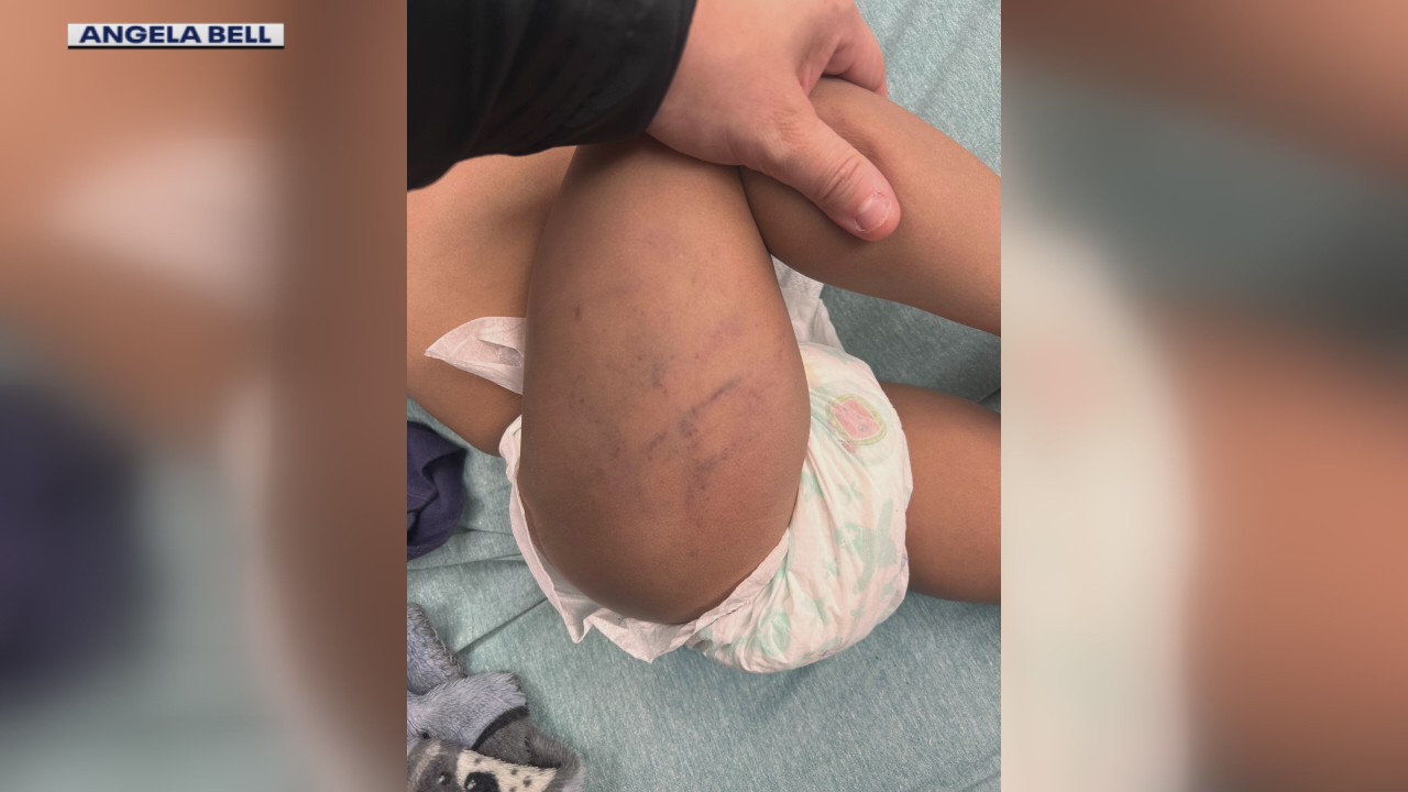 Mother of abused 1-year-old wants suspect to face consequences