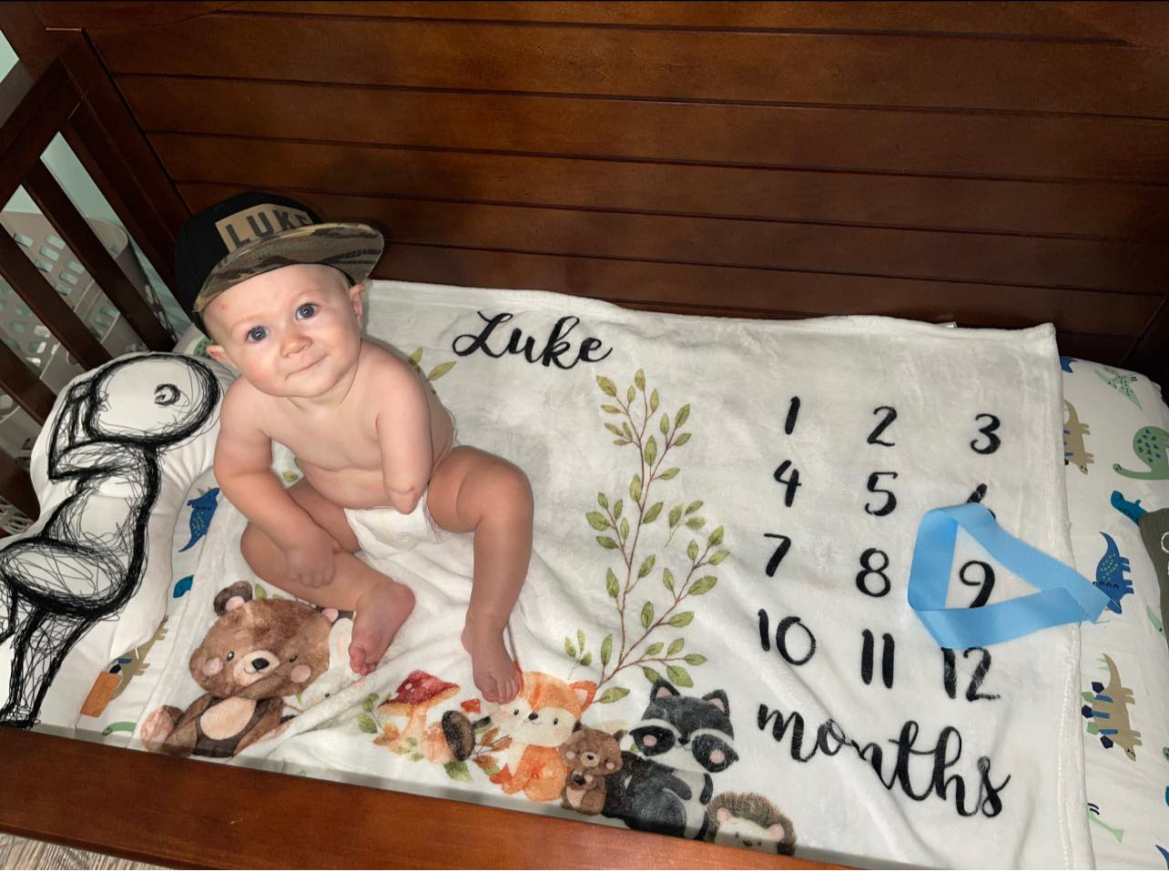 Infant born with cancer undergoes chemotherapy, amputation