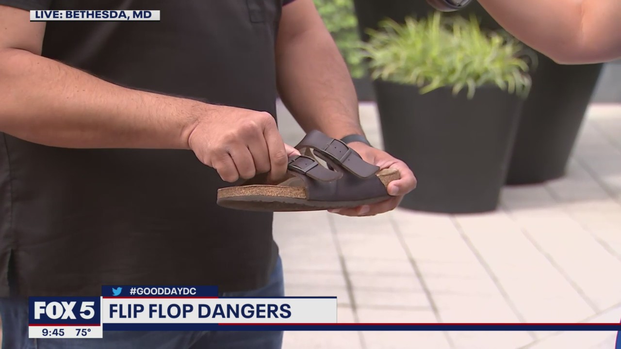 Flip flop dangers to be aware of this summer