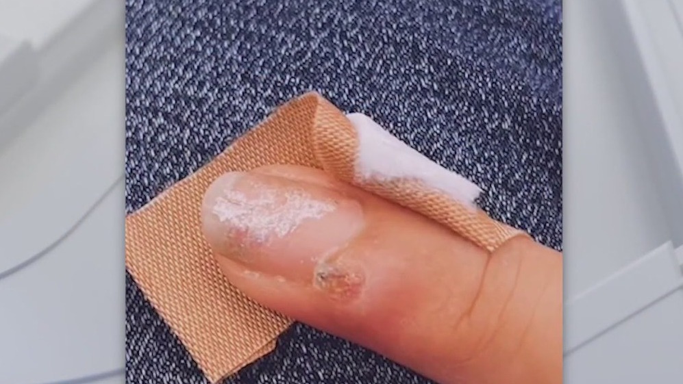 Woman claims trip to nail salon may have given her cancer