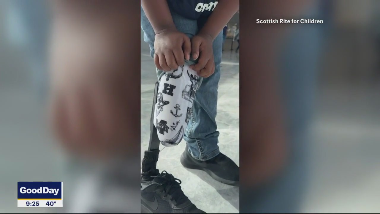 Young fan gets Dak's tattoos on his prosthetic leg