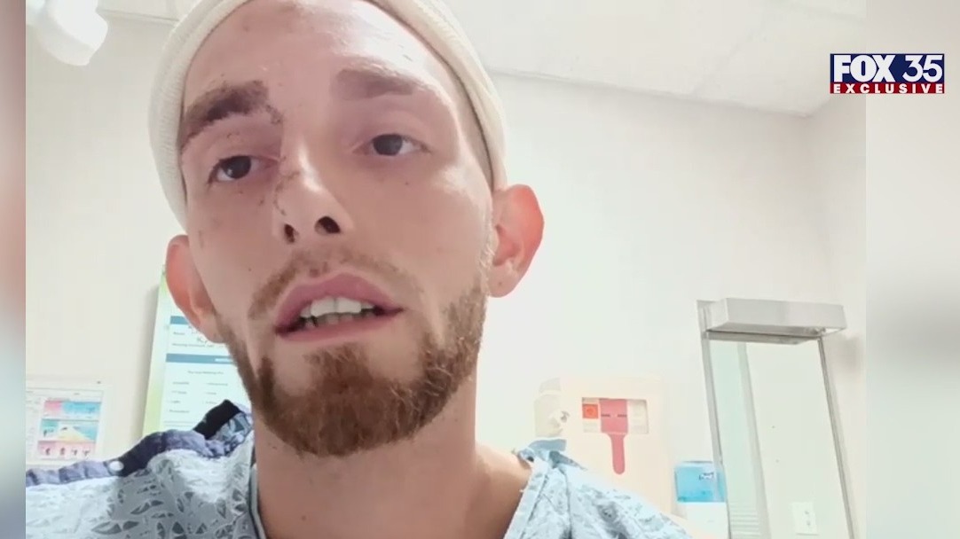 Club worker shot in downtown Orlando shooting wants more security