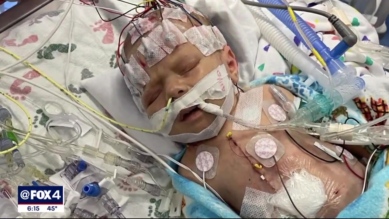 Dallas boy with rare heart defect nicknamed 'Frank the Tank' on road to recovery