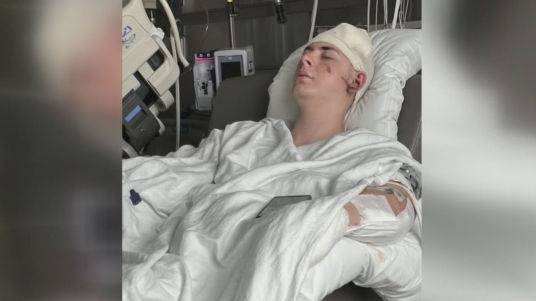 Machete attack victim speaks out