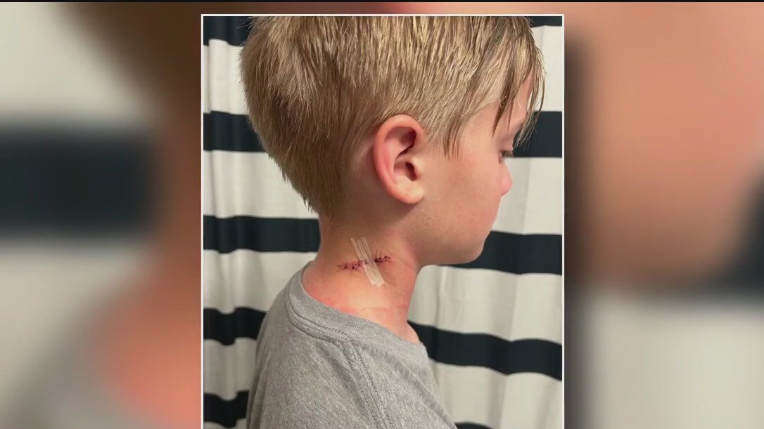 Minnesota kid recalls scary hockey accident