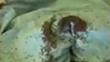 Video shows outbreak of lice in Fulton County jail
