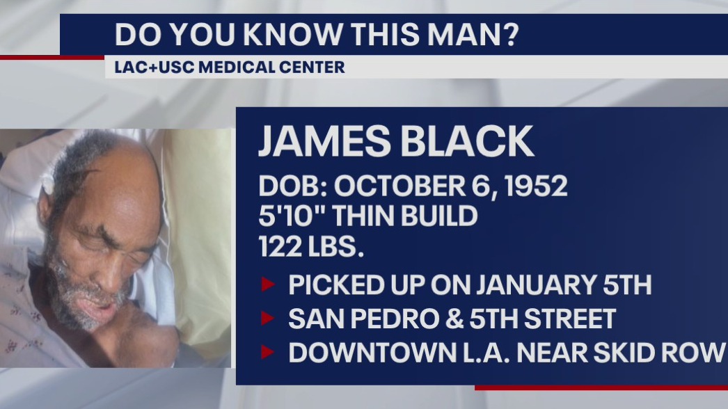 Do you know this man? Hospital officials searching for patient's family