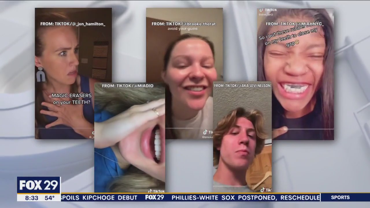 The dangers of social media's DIY dental hacks