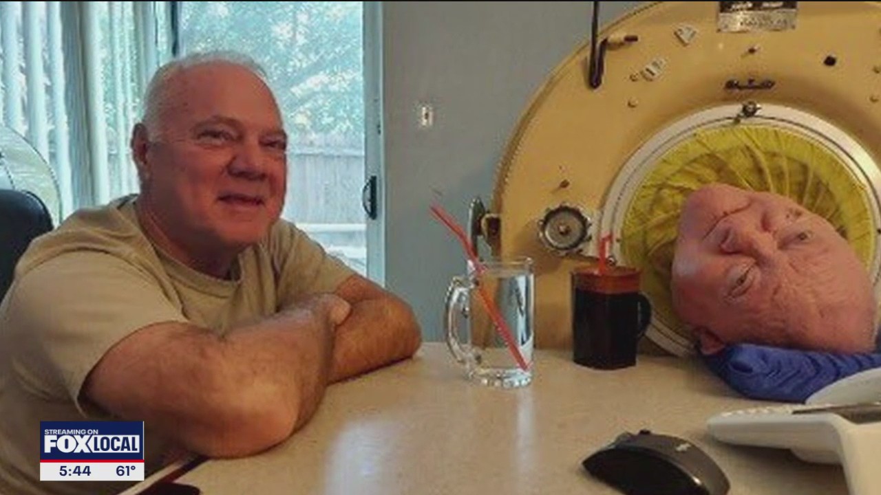 Paul Alexander's brother shares inspiring story