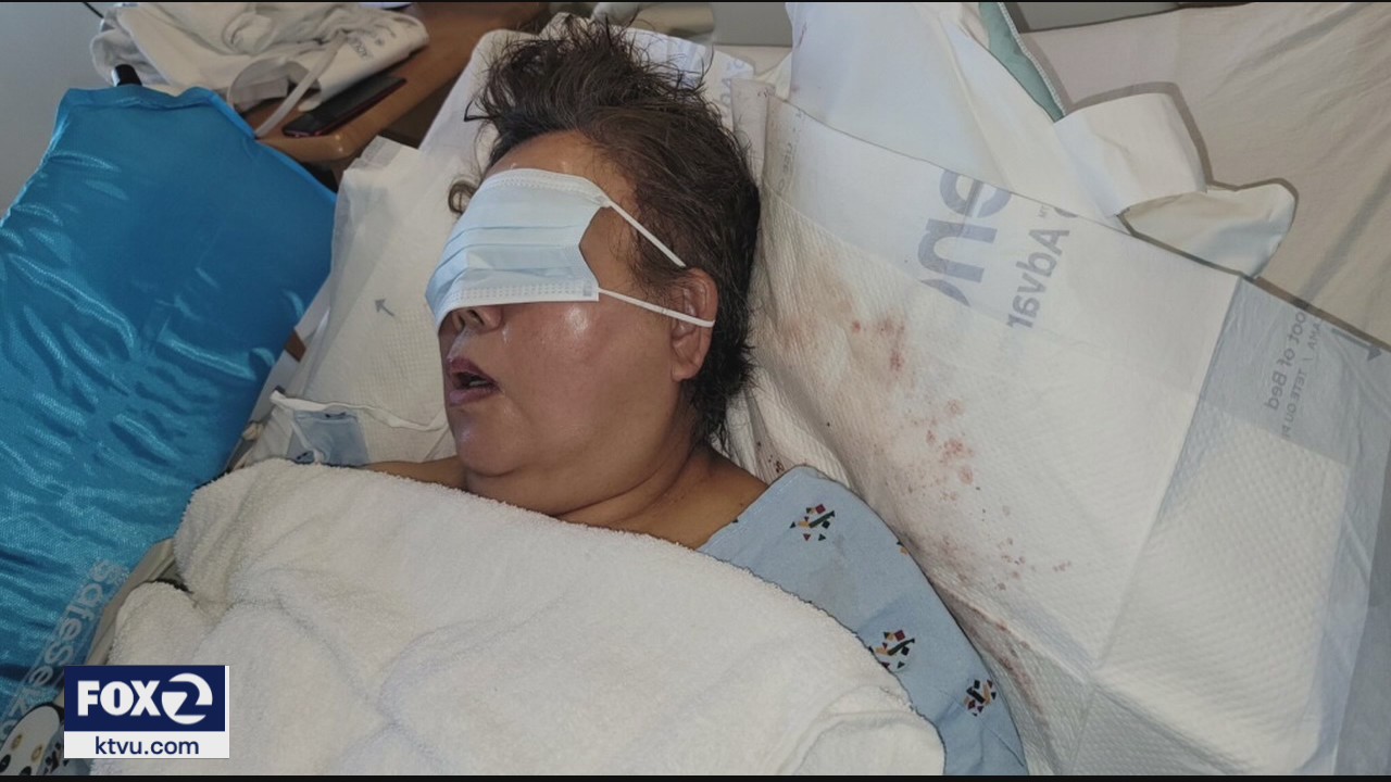 Woman beaten and robbed in Vallejo parking lot