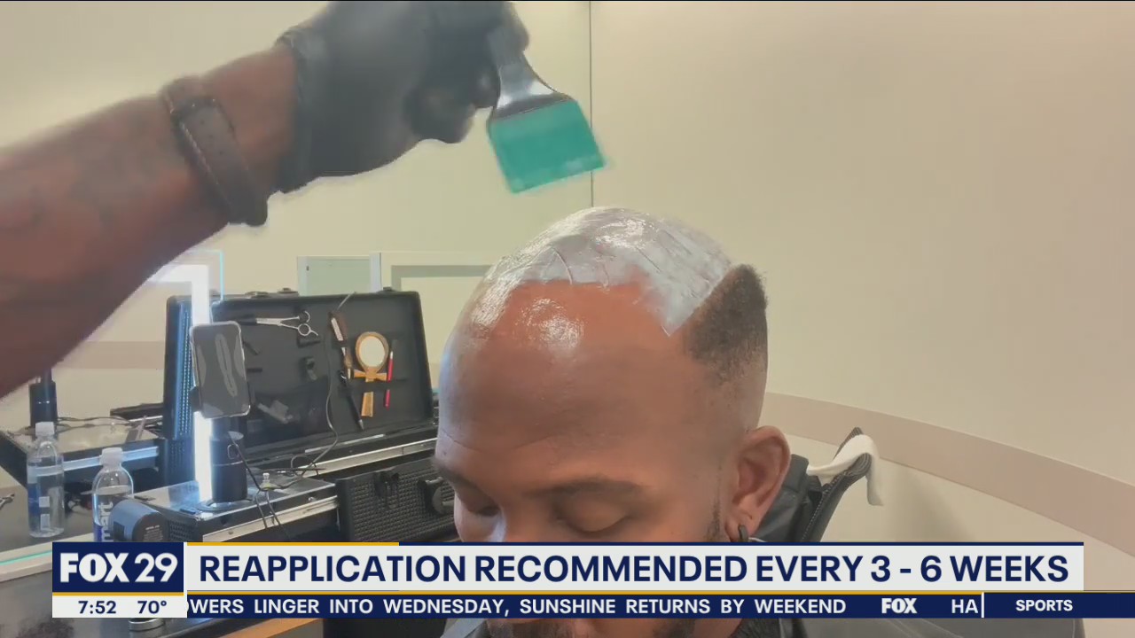 Men turn to hair units to help with hair loss