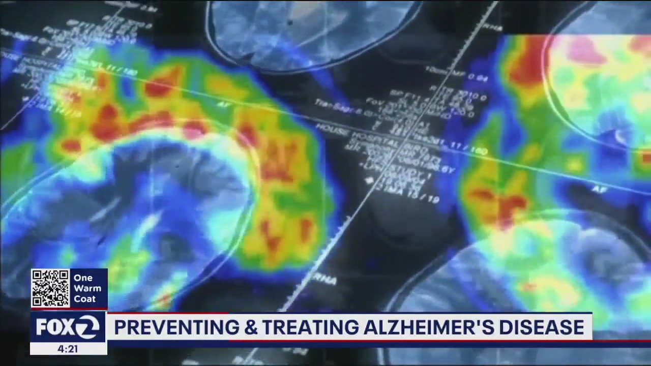 Preventing and treating Alzheimer's disease