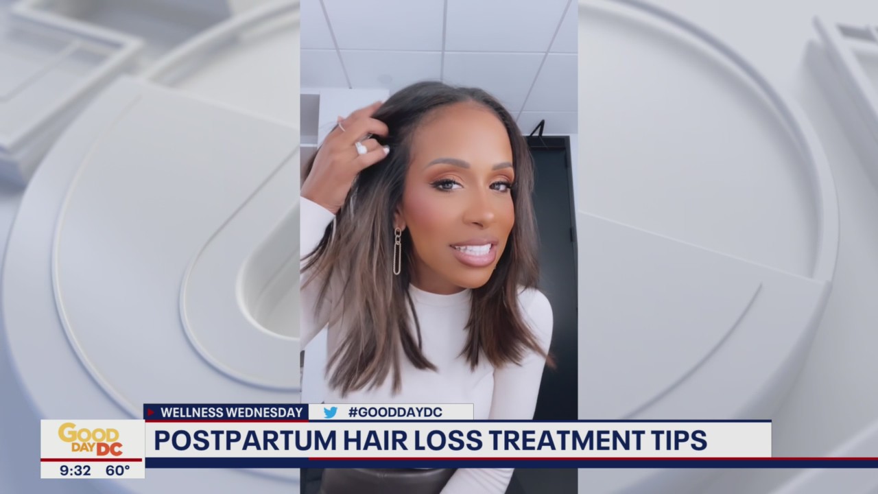 Answering viewer questions on postpartum hair loss