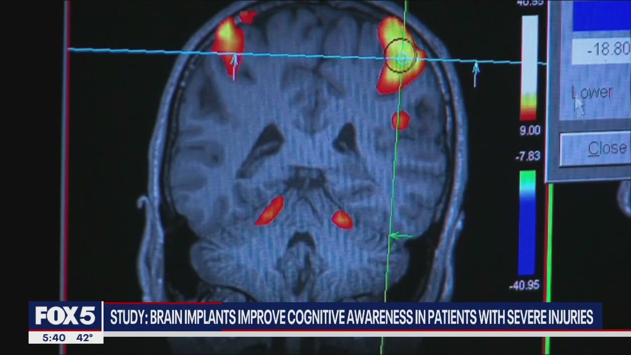 Walking pneumonia in kids on the rise