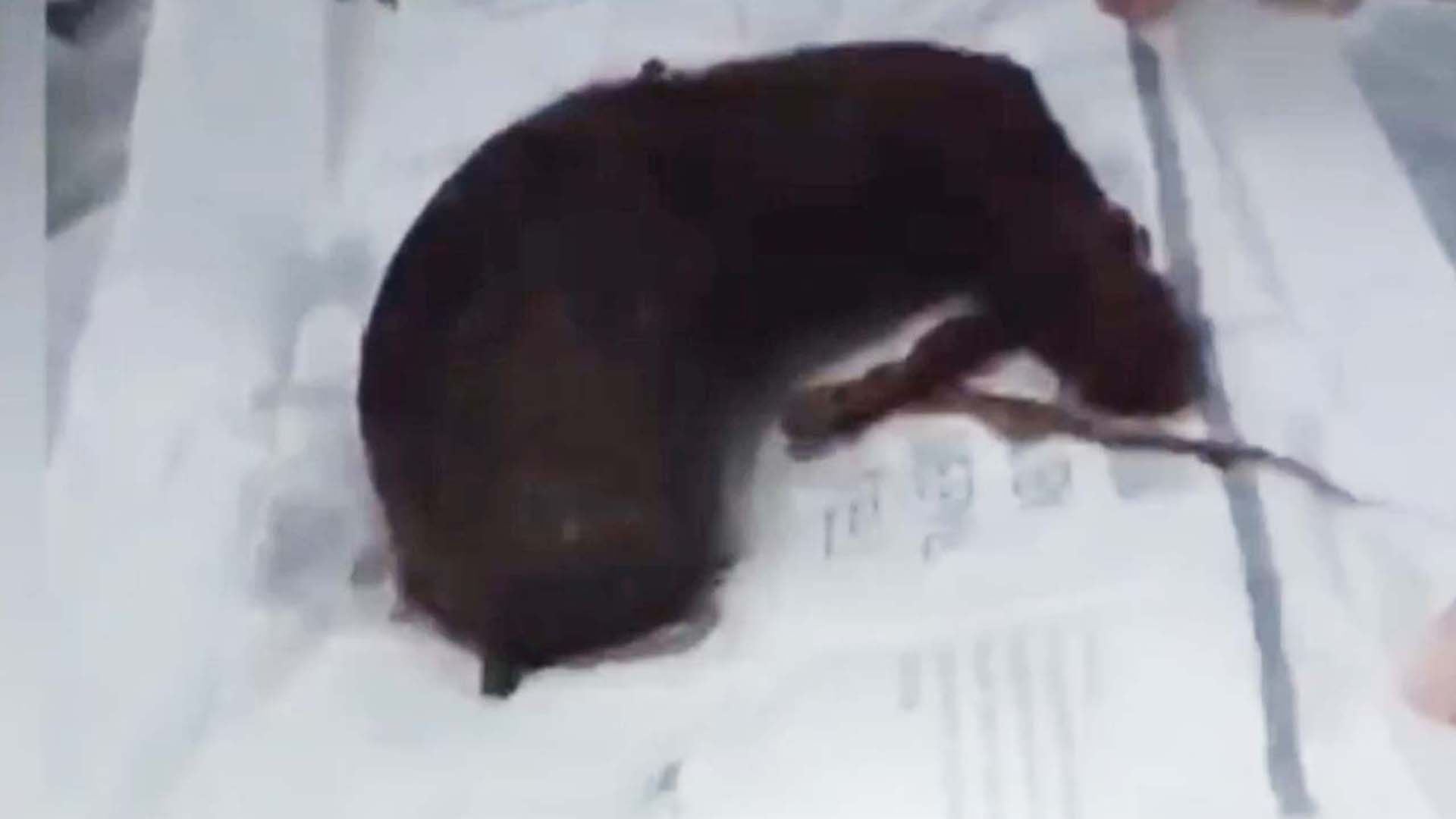 More than 6 lbs. of hair removed from young girl's stomach